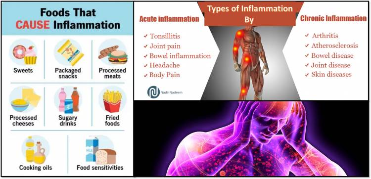 Top Inflammatory Foods To Disturb Your Health