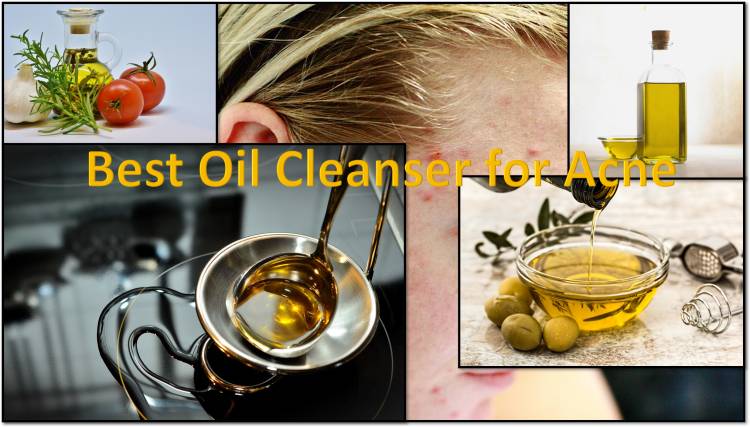 world Best Oil Cleanser for Acne