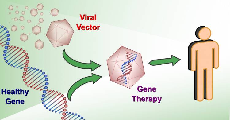Viral vector Gene Therapy