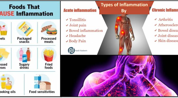 Top Inflammatory Foods To Disturb Your Health