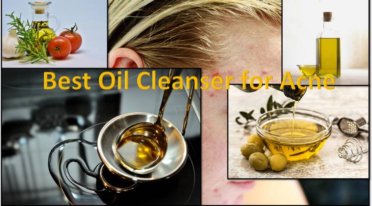 world Best Oil Cleanser for Acne