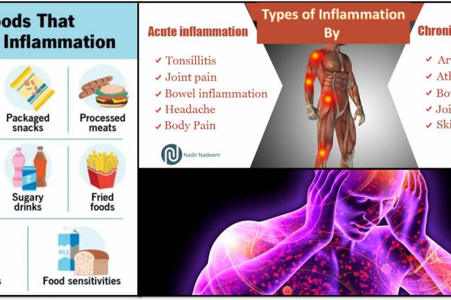 Top Inflammatory Foods To Disturb Your Health