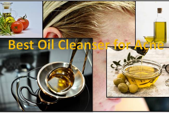 world Best Oil Cleanser for Acne